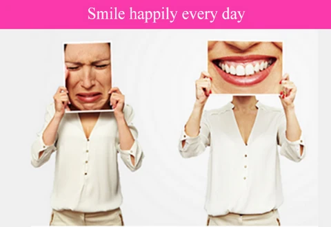 Smile Veneer Teeth Cover Set Instant Smile Makeover Home - Image 1